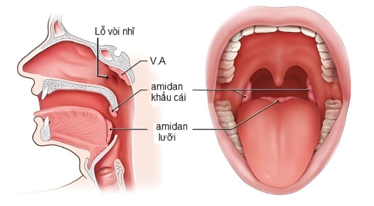 viem amidan o tre em nguyen nhan trieu chung va bien phap dieu tri